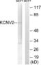 Potassium Voltage-Gated Channel Modifier Subfamily V Member 2 antibody, LS-C120239, Lifespan Biosciences, Western Blot image 
