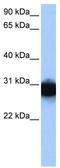 Triosephosphate Isomerase 1 antibody, TA346536, Origene, Western Blot image 