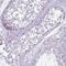 NBPF Member 6 antibody, PA5-61237, Invitrogen Antibodies, Immunohistochemistry frozen image 