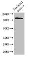 Schlafen Family Member 11 antibody, CSB-PA021760LA01HU, Cusabio, Western Blot image 