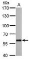 Histone Deacetylase 2 antibody, GTX112957, GeneTex, Western Blot image 