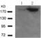 Insulin Receptor Substrate 1 antibody, TA322593, Origene, Western Blot image 