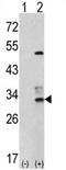 Capping Actin Protein Of Muscle Z-Line Subunit Beta antibody, AP17178PU-N, Origene, Western Blot image 
