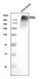 Ryanodine Receptor 2 antibody, A00155-2, Boster Biological Technology, Western Blot image 