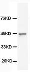Keratin 18 antibody, MA1026, Boster Biological Technology, Western Blot image 