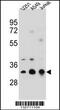 Tropomyosin 4 antibody, 56-627, ProSci, Western Blot image 