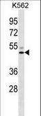 Hepatic lipase antibody, LS-C165791, Lifespan Biosciences, Western Blot image 