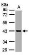 KLK11 antibody, GTX104200, GeneTex, Western Blot image 