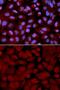 O-Linked N-Acetylglucosamine (GlcNAc) Transferase antibody, GTX32766, GeneTex, Immunocytochemistry image 