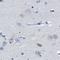 Hydroxysteroid 17-Beta Dehydrogenase 1 antibody, NBP1-84901, Novus Biologicals, Immunohistochemistry paraffin image 