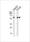 Glucokinase antibody, LS-C99459, Lifespan Biosciences, Western Blot image 