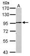 Zinc Finger Protein 408 antibody, NBP2-21007, Novus Biologicals, Western Blot image 