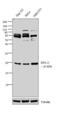 Ribosomal Protein L11 antibody, PA5-27468, Invitrogen Antibodies, Western Blot image 