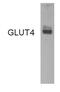 Solute Carrier Family 2 Member 4 antibody, GTX79317, GeneTex, Western Blot image 
