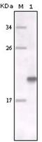 MER Proto-Oncogene, Tyrosine Kinase antibody, AM06188SU-N, Origene, Western Blot image 