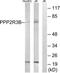 Protein Phosphatase 2 Regulatory Subunit B'Delta antibody, TA312818, Origene, Western Blot image 
