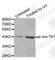 Jun Proto-Oncogene, AP-1 Transcription Factor Subunit antibody, AP0379, ABclonal Technology, Western Blot image 