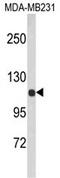Actinin Alpha 1 antibody, AP17086PU-N, Origene, Western Blot image 