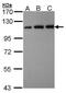 USO1 Vesicle Transport Factor antibody, PA5-28427, Invitrogen Antibodies, Western Blot image 