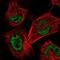 Hexon protein antibody, NBP1-83278, Novus Biologicals, Immunofluorescence image 