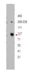 ATP Binding Cassette Subfamily B Member 5 antibody, A02979, Boster Biological Technology, Western Blot image 