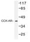 Cholecystokinin A Receptor antibody, AP01210PU-N, Origene, Western Blot image 