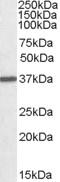 Arginase 1 antibody, MBS422008, MyBioSource, Western Blot image 