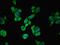 Chromosome 19 Open Reading Frame 48 antibody, LS-C675438, Lifespan Biosciences, Immunofluorescence image 