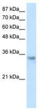 Ribonuclease H2 Subunit A antibody, TA345963, Origene, Western Blot image 