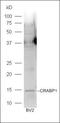 Cellular retinoic acid-binding protein 1 antibody, orb182729, Biorbyt, Western Blot image 