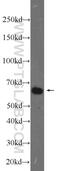 Inactive ubiquitin-specific peptidase 39 antibody, 23865-1-AP, Proteintech Group, Western Blot image 