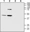 Melatonin Receptor 1B antibody, PA5-77491, Invitrogen Antibodies, Western Blot image 