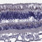 Collagen alpha-1(IX) chain antibody, HPA074749, Atlas Antibodies, Immunohistochemistry paraffin image 