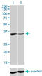 Fragile X mental retardation 1 protein antibody, LS-C197237, Lifespan Biosciences, Western Blot image 