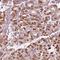 Ceroid-lipofuscinosis neuronal protein 6 antibody, HPA066046, Atlas Antibodies, Immunohistochemistry frozen image 