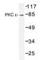 Protein Kinase C Epsilon antibody, AP20353PU-N, Origene, Western Blot image 