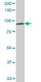 DEAD-Box Helicase 1 antibody, LS-C197038, Lifespan Biosciences, Western Blot image 