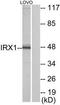 Iroquois Homeobox 1 antibody, TA315778, Origene, Western Blot image 