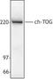 Cytoskeleton Associated Protein 5 antibody, LS-C41286, Lifespan Biosciences, Western Blot image 