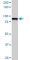 Autoantigen NOR-90 antibody, H00007343-M02, Novus Biologicals, Western Blot image 