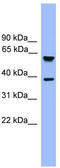 F-Box And Leucine Rich Repeat Protein 12 antibody, TA342606, Origene, Western Blot image 