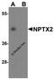Neuronal Pentraxin 2 antibody, A09667, Boster Biological Technology, Western Blot image 