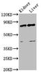 SUZ12 Polycomb Repressive Complex 2 Subunit antibody, LS-C679708, Lifespan Biosciences, Western Blot image 