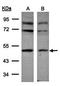Neuregulin-1 antibody, orb13479, Biorbyt, Western Blot image 