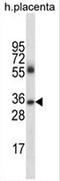 Immunoglobulin Heavy Constant Gamma 4 (G4m Marker) antibody, AP52171PU-N, Origene, Western Blot image 