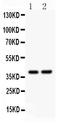 SRY-Box 1 antibody, LS-C357589, Lifespan Biosciences, Western Blot image 