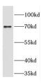 Cartilage acidic protein 1 antibody, FNab01996, FineTest, Western Blot image 