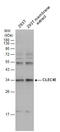 C-Type Lectin Domain Family 4 Member E antibody, GTX131096, GeneTex, Western Blot image 