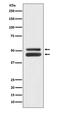 Mitogen-Activated Protein Kinase 8 antibody, M02608, Boster Biological Technology, Western Blot image 