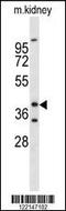 Forkhead Box L1 antibody, 63-839, ProSci, Western Blot image 